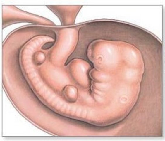 Día 29 > Yemas de los brazos y las piernas visibles