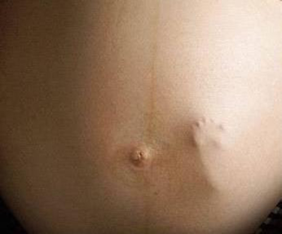 Movimientos fetales.