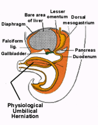 Día 36 > Hernia umbilical fisiológica