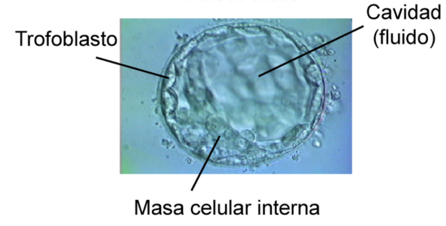 Blastocisto