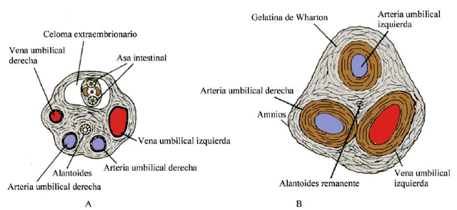 Cordón umbilical