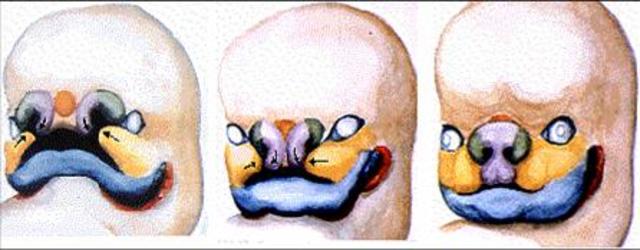 Formación de la nariz