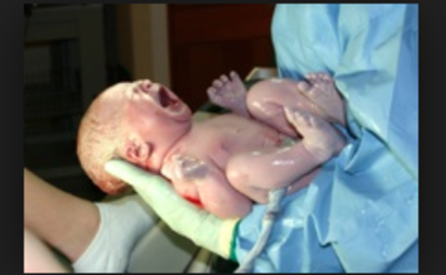 35-38 SDG (a nacimiento)