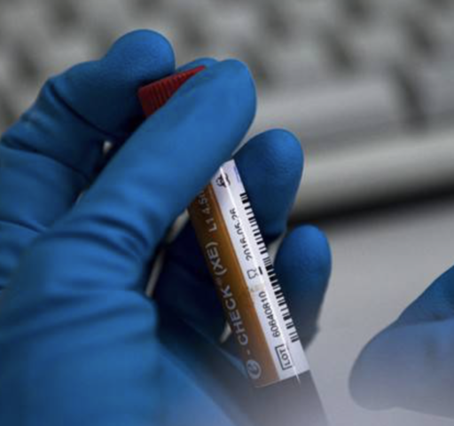 Positive Testing for Drugs