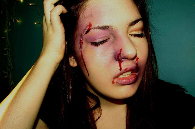 The Health Costs of Violence: Measuring the Burden of Disease Caused by Intimate Partner Violence Published