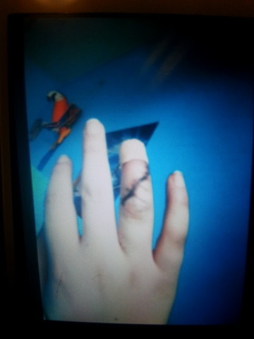 Casi me corte el dedo