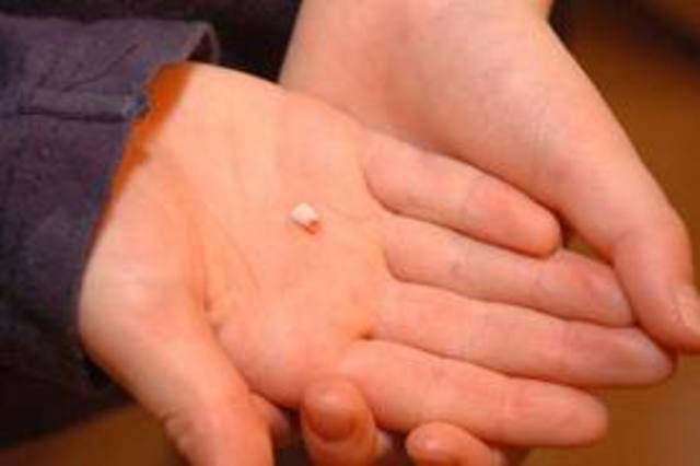 my first baby tooth