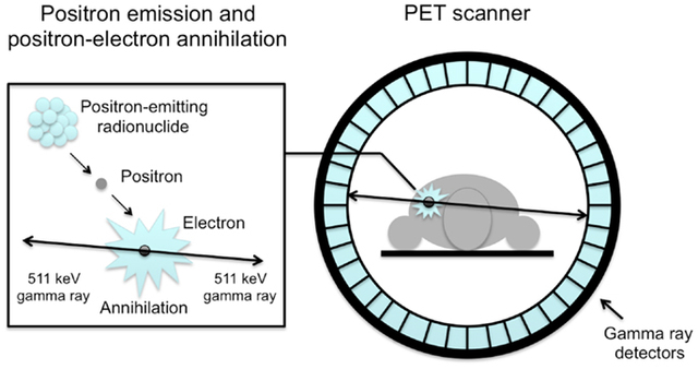 Estudios de Positrones PET (positron emission tomography)