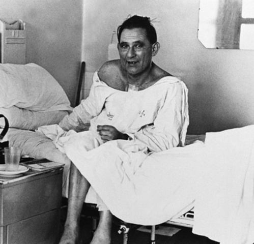 First Heart Transplant (Africa)