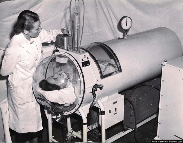 The invention of the iron lung.  Photo credit:  rarehistoricalphotos.com.
