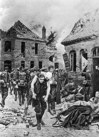 Hitler injures Leg in WW1!