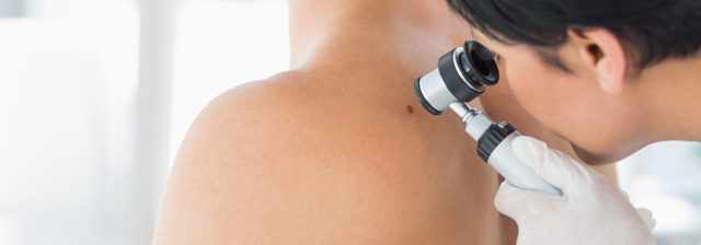 have a skin cancer screening