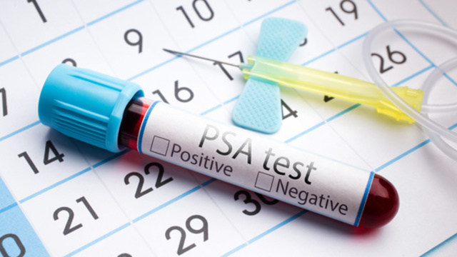 have prostate cancer screening