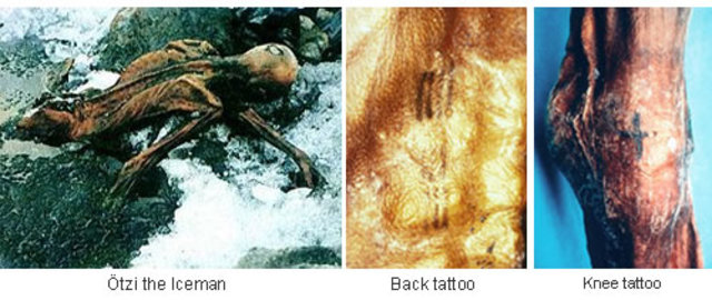 Ötzi the Iceman