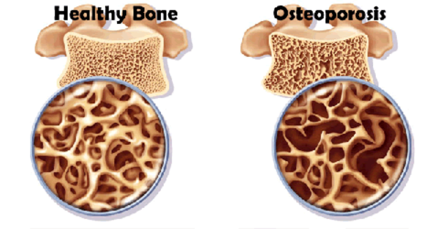 Health care recommendations for your 60s