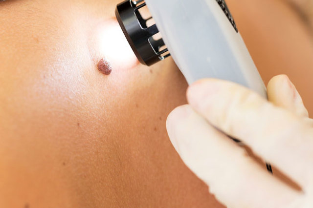 Health concerns for your 40s