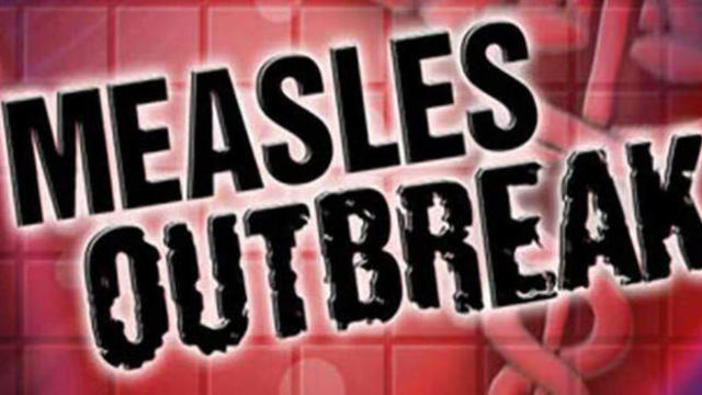 Measles outbreak