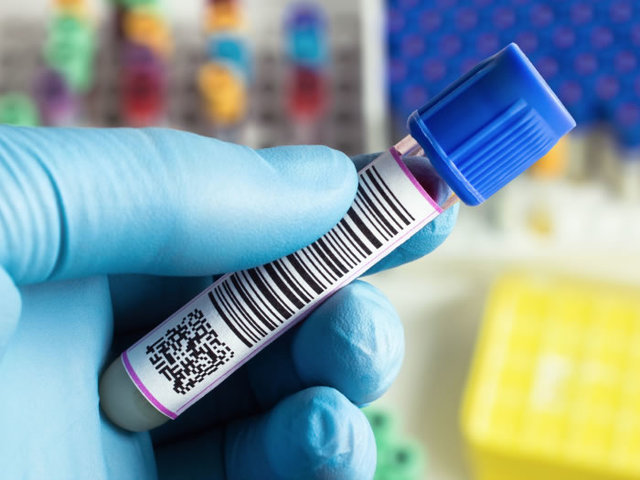 El código de barras