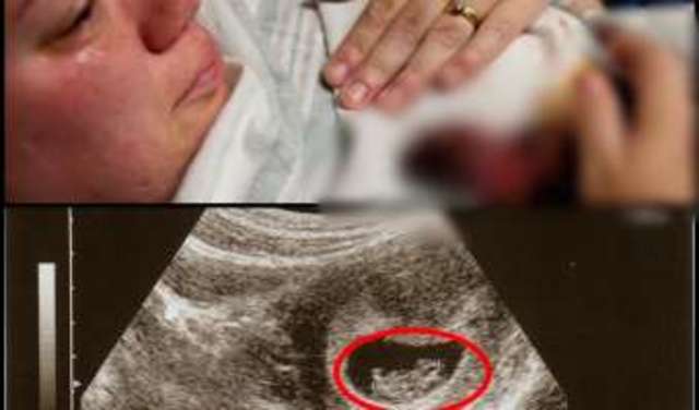 Protocolo de Groningen, Holanda