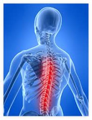 Atención a lesiones medulares, España