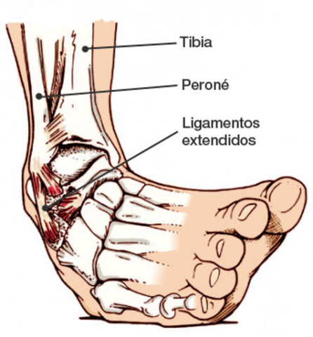lesionado por 3 ves de lo mismo