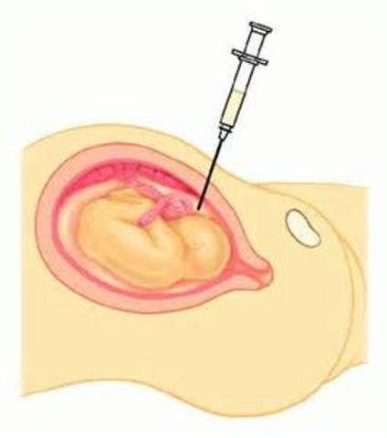 Diagnóstico prenatal de una enfermedad humana