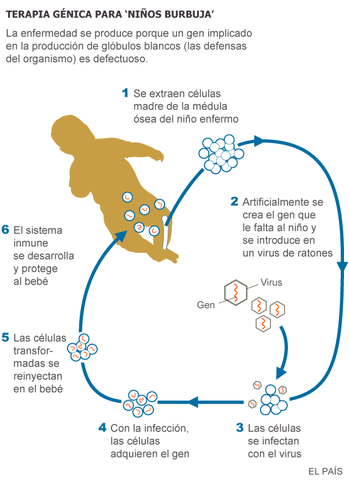 Primer tratamiento de terapia génica con éxito en niños