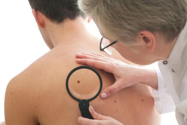Baseline skin exam to determine your skin cancer risk