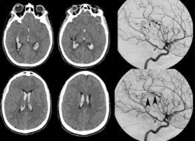 Structural Neuroimaging