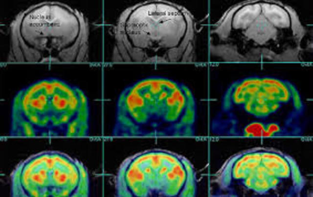 Functional Neuroimaging