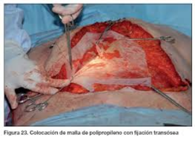 DECRETO 2423 DE 1996