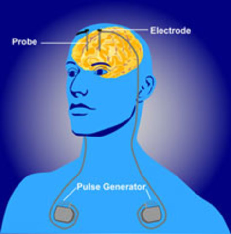 Electrical Stimulation of the Brain