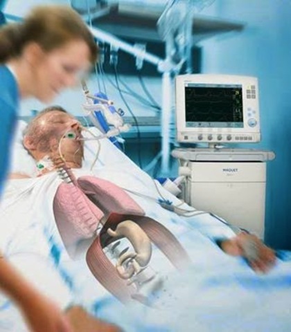 Curso Manejo de paciente con ventilacion Mecanica