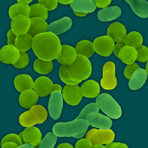 La terapia génica entra en guerra contra el cáncer;  Se completa la primera secuencia de un genoma de un organismo vivo diferente de virus para la bacteria Haemophilus influenzae.