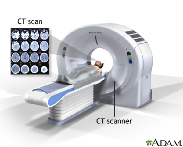 Computerised tomography (CT)