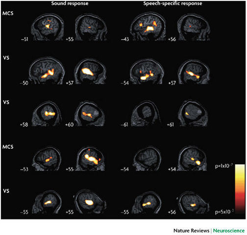 functional neuroimagaing