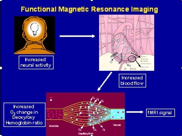 Functional Magnetic Resonance Imaging (fMRI)