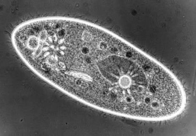 Phase contrast microscope