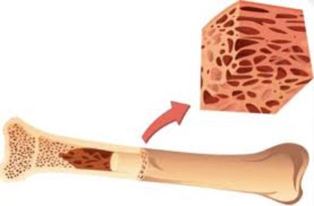 Bone Mineral Density Test