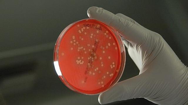 Primer cultivo de tejidos.