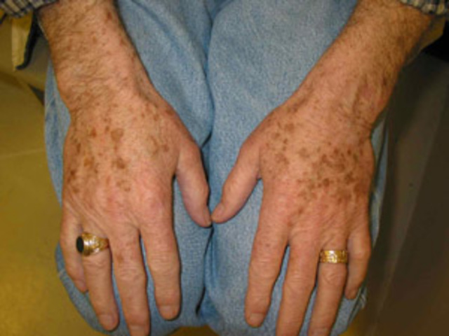 Preventive Health Care - 40s