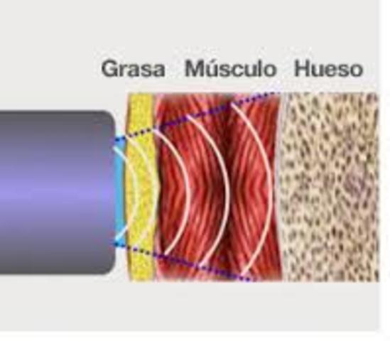 Modelo de composición corporal