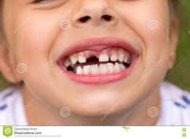 Se me cayo mi primer diente