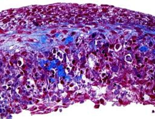 Henri Dutrochet discovers that tissues are composed of living cells.