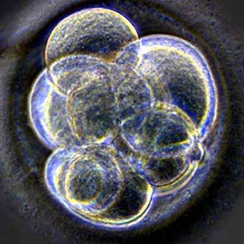 Ingeniería Genética