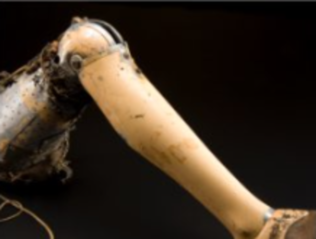 Knee Sockets Were Introduced