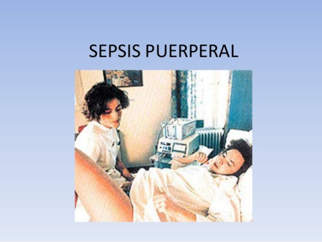Sepsis puerperal