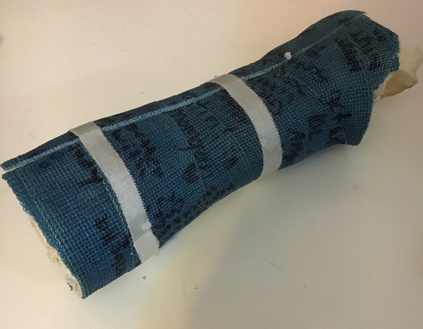 First Fractured Bone