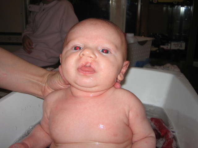 Baby number five, Trever