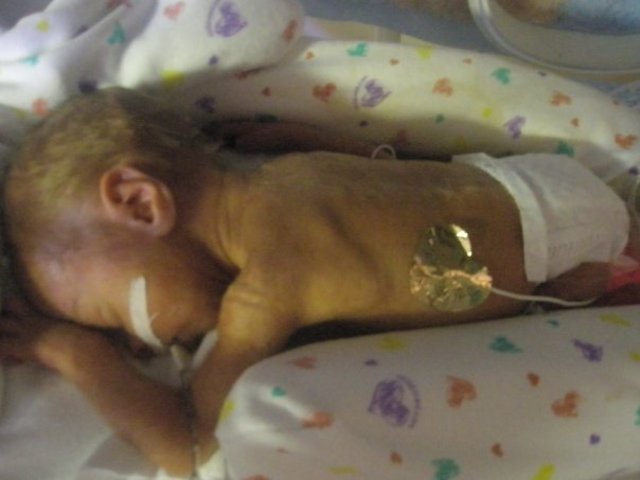 My first Miracle Logan was born